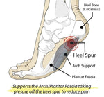 FootMatters Arch Support Cushions - Prevent Foot Pain - Foot Matters